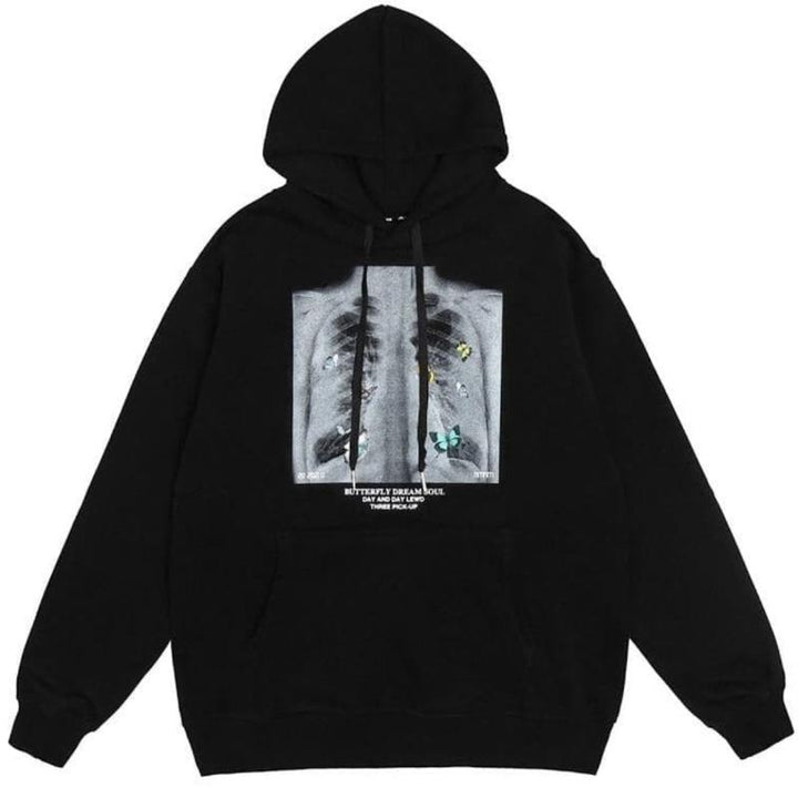 Icy Minded. A black hoodie featuring a striking x-ray image of a chest, blending style with a unique medical twist.